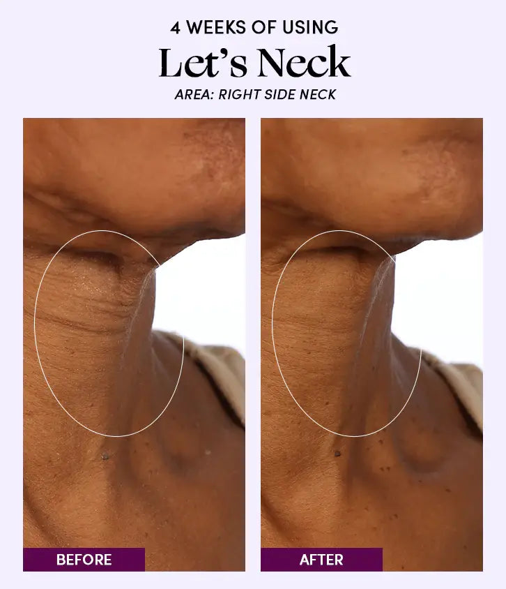 Let's Neck - Neck Serum