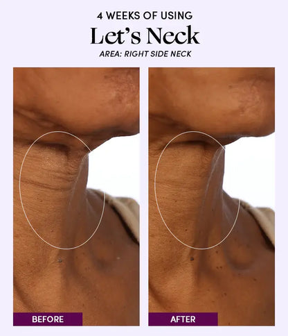 Let's Neck - Neck Serum