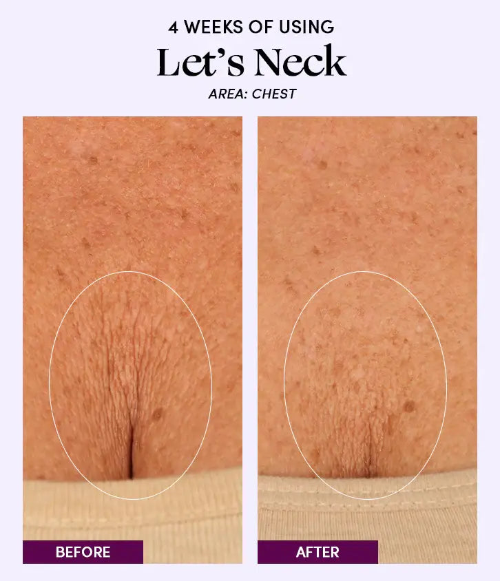 Let's Neck - Neck Serum