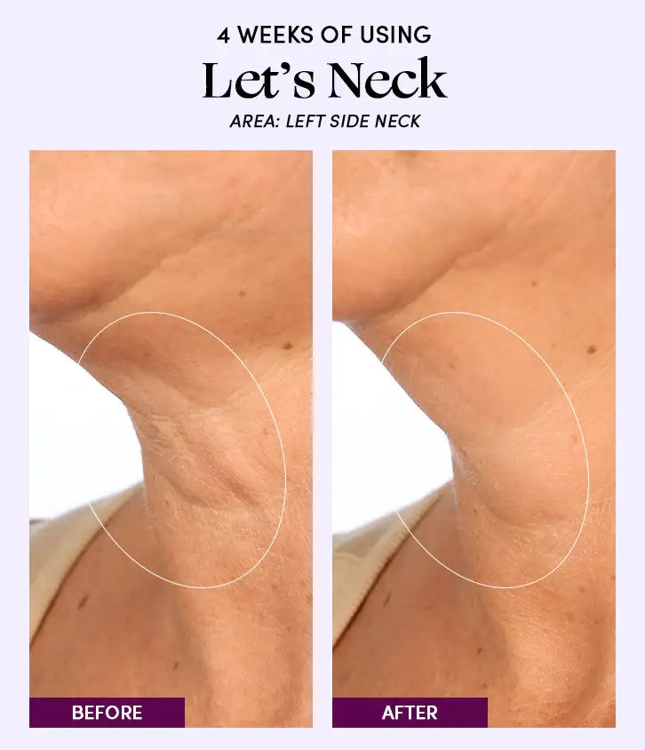 Let's Neck - Neck Serum
