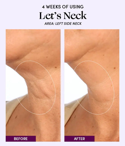 Let's Neck - Neck Serum